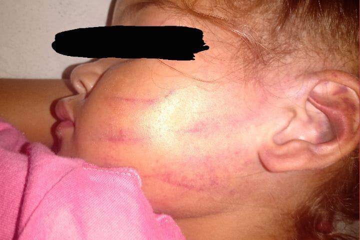 criança agredida sjc