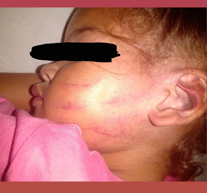 criança agredida sjc
