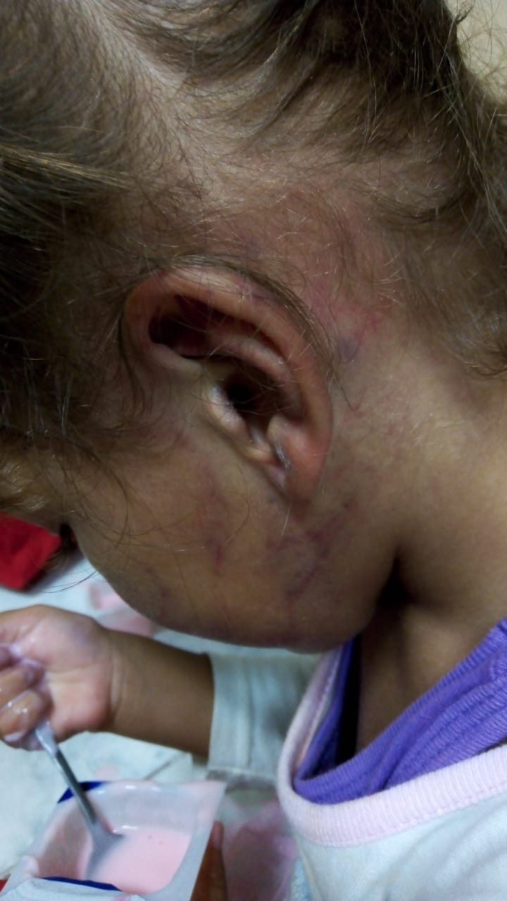agressão menina creche sjc