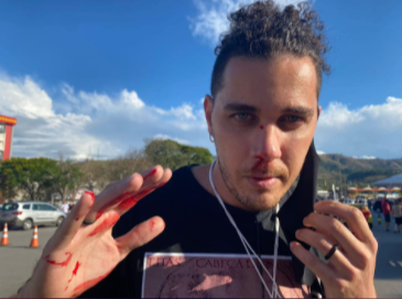 cinegrafista agredido