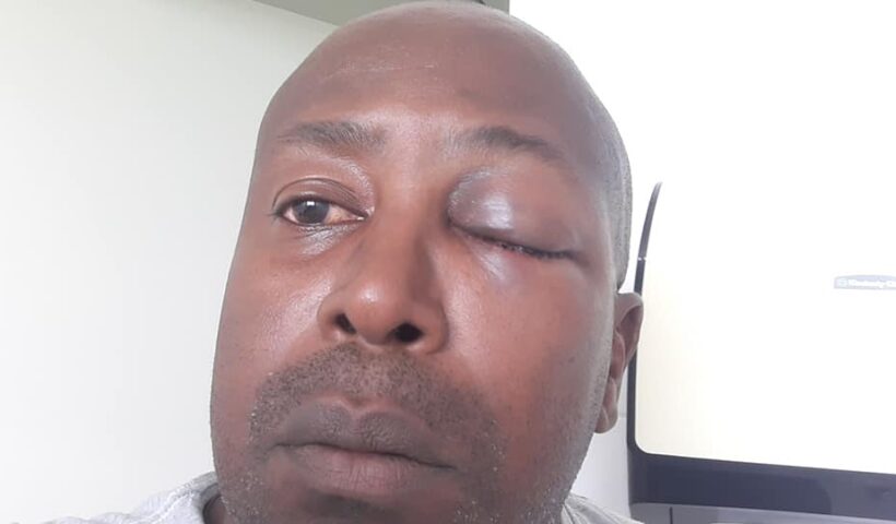 árbitro agredido caçapava