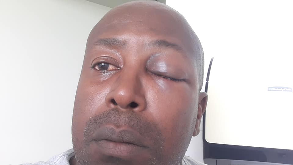 árbitro agredido caçapava