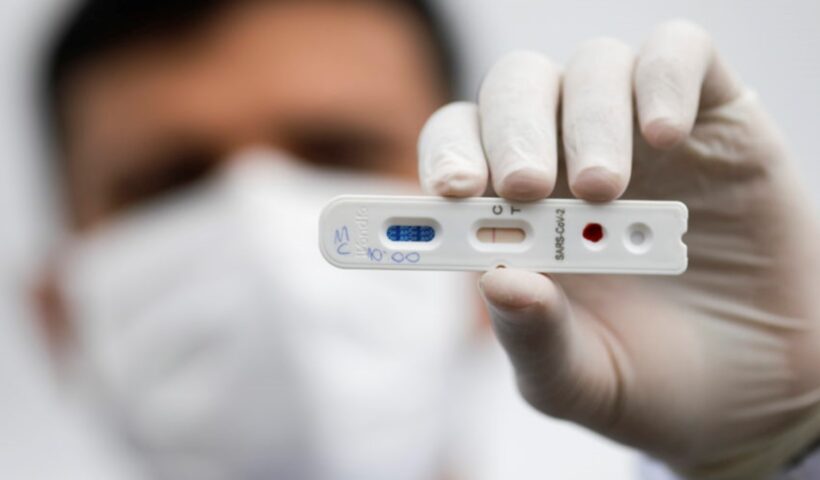 Dispara a quantidade de testes positivos para covid nas farmácias do País