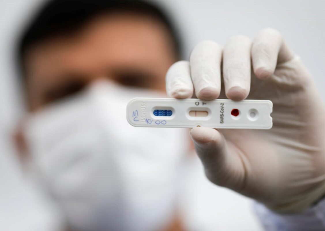 Profissional da saúde, com máscara e luvas, mostra resultado de tests para Covid. Vale do paraíba apresentou queda no número de portes por covid e também nas internações