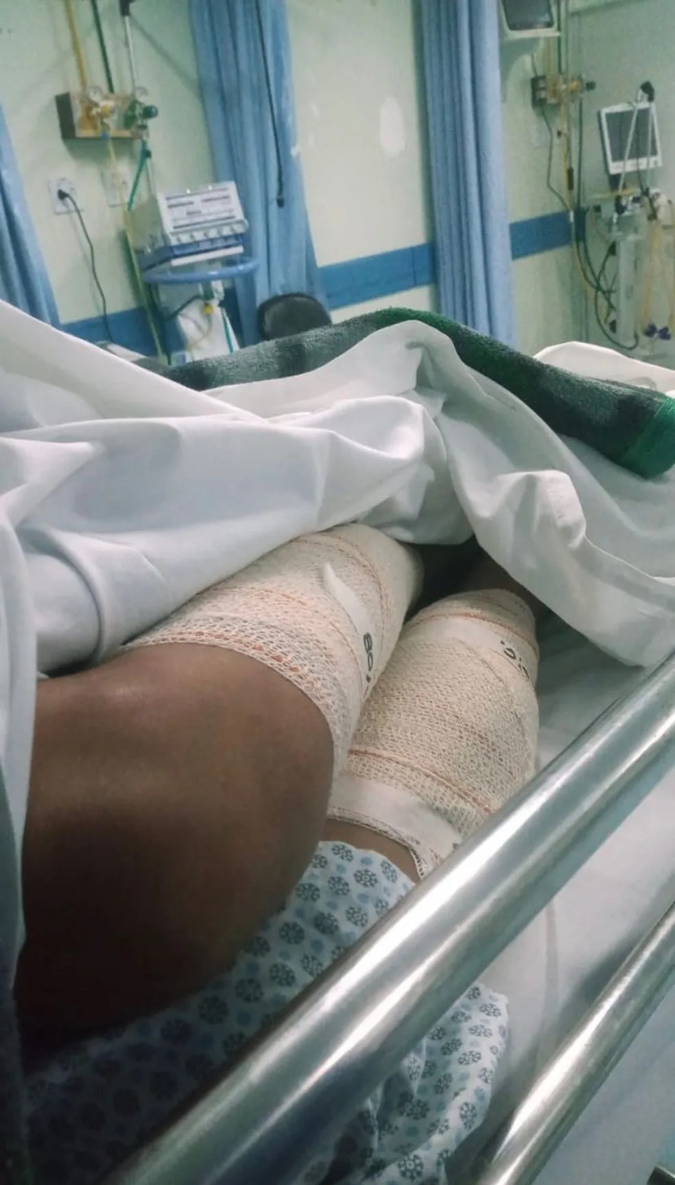 criança de 12 anos é atacado por pitbull em sjc