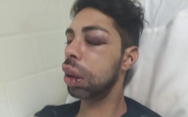 Foto de Wanderlan Lucas Barbarossa, conhecido como Miss Drag Queen, internado em hospital