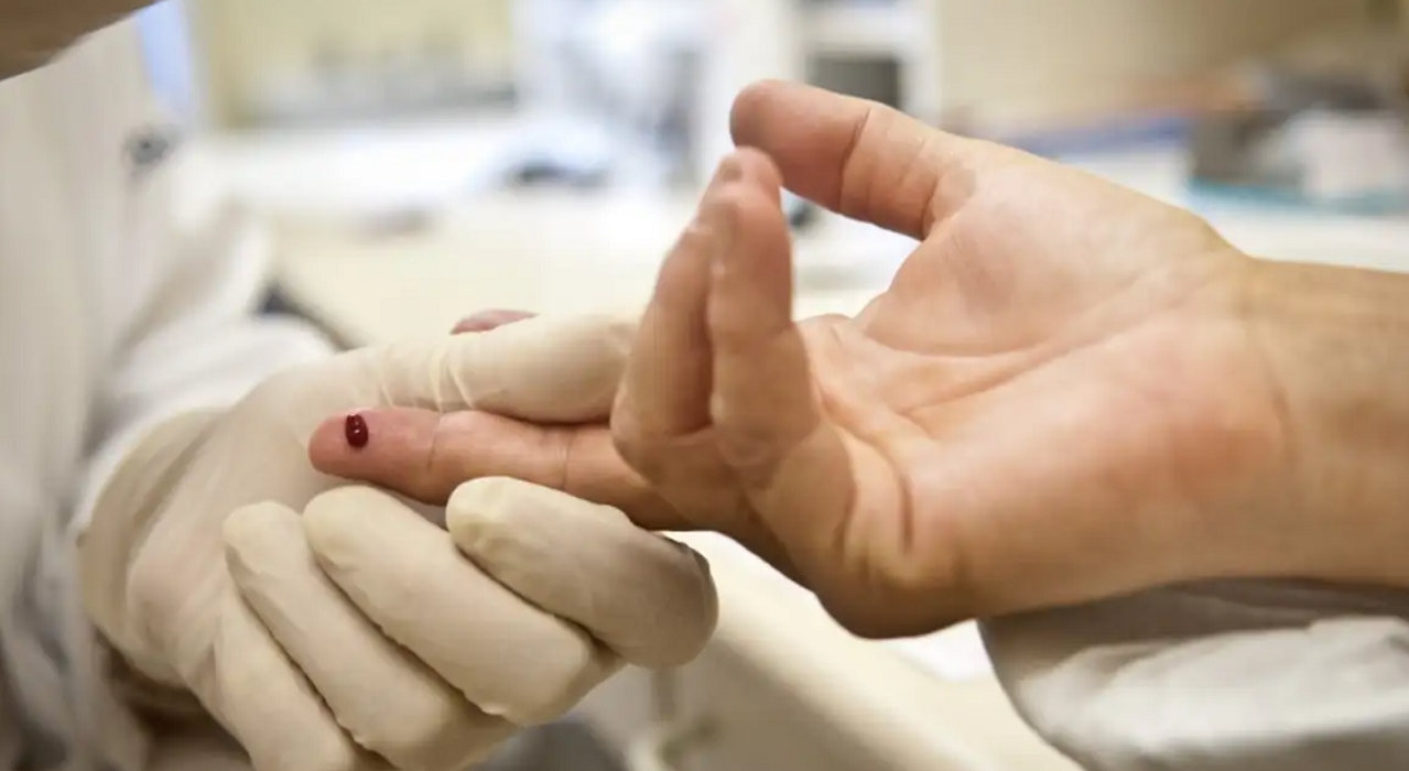 mão de enfermeira usando luvas coleta gota de sangue de dedo de paciente. Casos de sífilis e de HIV/aids aumentam entre homens jovens