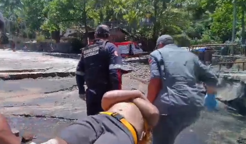 ATENÇÃO TURISTAS: homem fratura perna ao sofrer queda em Ilhabela