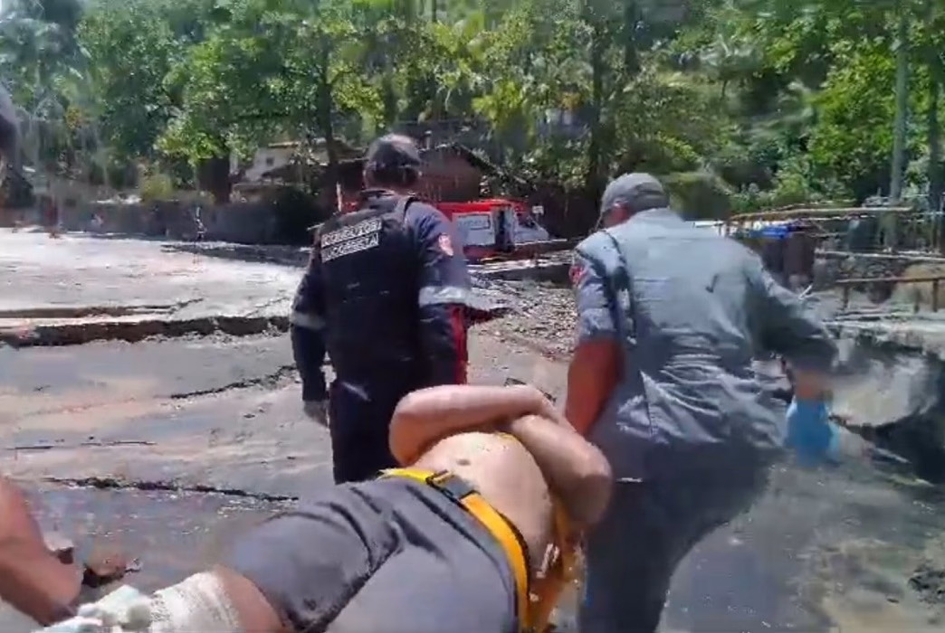 ATENÇÃO TURISTAS: homem fratura perna ao sofrer queda em Ilhabela
