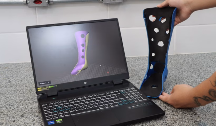 Alunos da USP de Lorena criam órteses em 3D de baixo custo para crianças