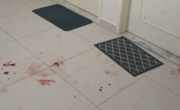 O hall do condomínio apresentava grande quantidade de sangue e sinais da briga