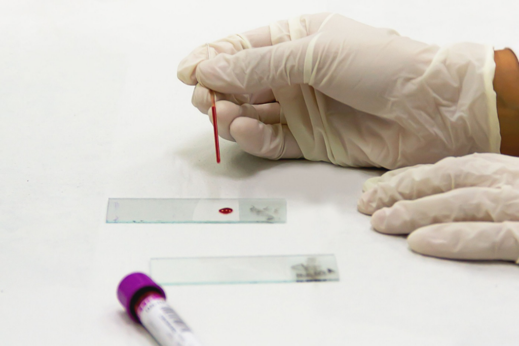 : Jacareí oferece testes rápidos gratuitos para HIV, sífilis e hepatites B e C até dezembro, com atendimento nas unidades de saúde.