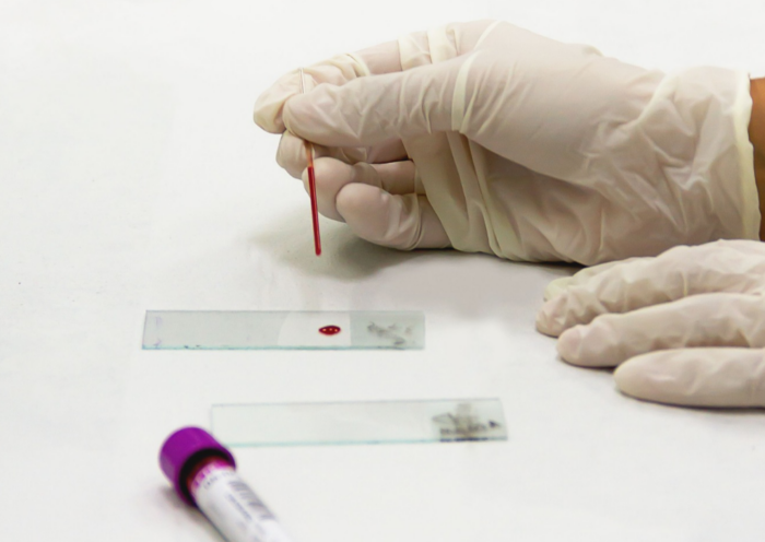 : Jacareí oferece testes rápidos gratuitos para HIV, sífilis e hepatites B e C até dezembro, com atendimento nas unidades de saúde.
