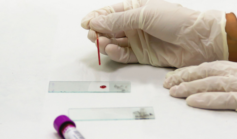 : Jacareí oferece testes rápidos gratuitos para HIV, sífilis e hepatites B e C até dezembro, com atendimento nas unidades de saúde.